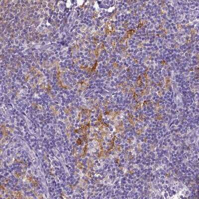 Immunohistochemistry-Paraffin: CD40/TNFRSF5 Antibody [NBP2-33956]