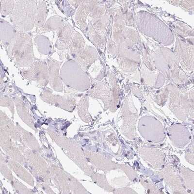 Immunohistochemistry-Paraffin: CD40/TNFRSF5 Antibody [NBP2-33956]