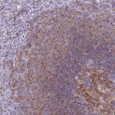 Immunohistochemistry-Paraffin: CD40/TNFRSF5 Antibody [NBP2-33956]