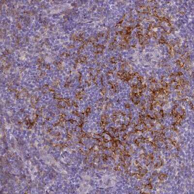 Immunohistochemistry-Paraffin: CD40/TNFRSF5 Antibody [NBP2-33956]