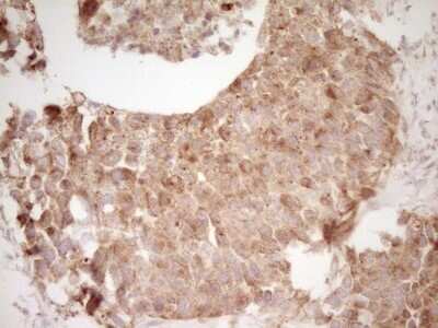 Immunohistochemistry: CD40/TNFRSF5 Antibody (OTI8B8) - Azide and BSA Free [NBP2-70378]