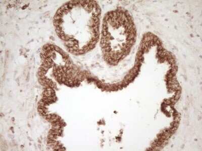 Immunohistochemistry: CD40/TNFRSF5 Antibody (OTI8B8) - Azide and BSA Free [NBP2-70378]