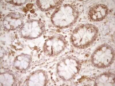 Immunohistochemistry: CD40/TNFRSF5 Antibody (OTI8B8) - Azide and BSA Free [NBP2-70378]