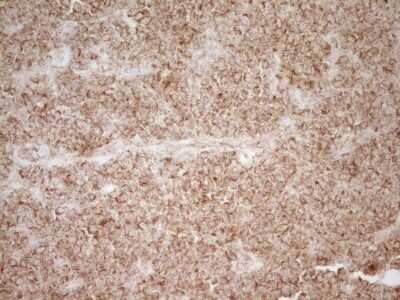Immunohistochemistry: CD40/TNFRSF5 Antibody (OTI8B8) - Azide and BSA Free [NBP2-70378]