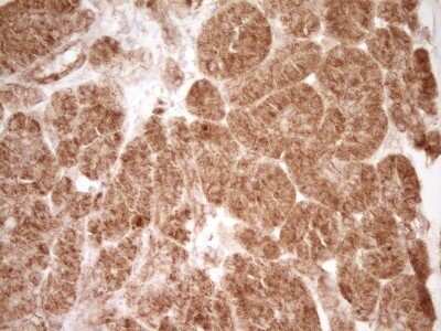 Immunohistochemistry: CD40/TNFRSF5 Antibody (OTI8B8) - Azide and BSA Free [NBP2-70378]
