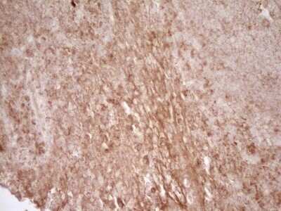 Immunohistochemistry: CD40/TNFRSF5 Antibody (OTI8B8) - Azide and BSA Free [NBP2-70378]