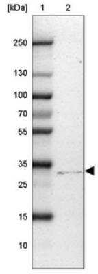 Western Blot: CD40/TNFRSF5 Antibody [NBP2-33957]