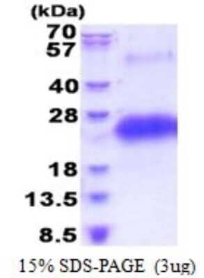 SDS-PAGE: Recombinant Human CD40/TNFRSF5 His Protein [NBP2-51628]