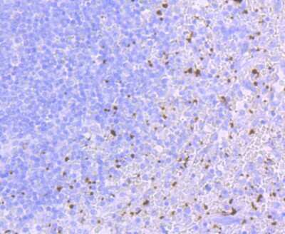 Immunohistochemistry-Paraffin: CD41/CD61 Antibody (JM11-19) [NBP2-66757]