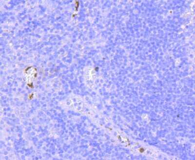 Immunohistochemistry-Paraffin: CD41/CD61 Antibody (JM11-19) [NBP2-66757]