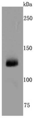 Western Blot: CD41/CD61 Antibody (JM11-19) [NBP2-66757]