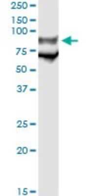 Immunoprecipitation: CD42b/GPIb alpha Antibody (1C6) [H00002811-M02]