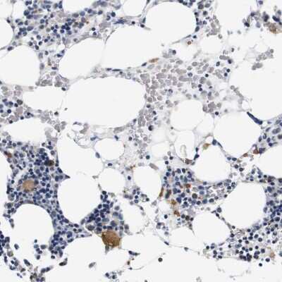 Immunohistochemistry-Paraffin: CD42b/GPIb alpha Antibody [NBP1-85749]