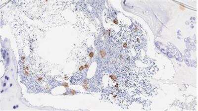 Immunohistochemistry-Paraffin: CD42b/GPIb alpha Antibody (MM2/174) [NBP1-28457]