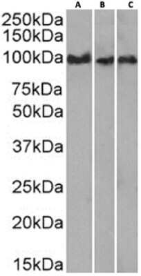 Western Blot: CD43/Sialophorin Antibody (84-3C1)ChimericAzide and BSA Free [NBP3-12075]