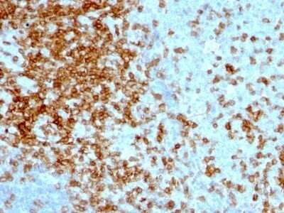 Immunohistochemistry-Paraffin: CD43/Sialophorin Antibody (84-3C1) - IHC-Prediluted [NBP2-48380]