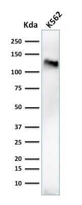 Western Blot: CD43/Sialophorin Antibody (84-3C1) [NBP2-44649]