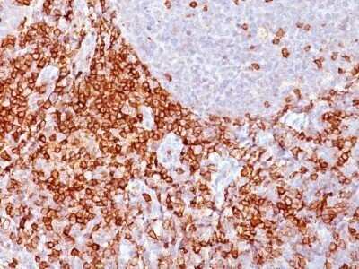 Immunohistochemistry-Paraffin: CD43/Sialophorin Antibody (Bra7G) - IHC-Prediluted [NBP2-48393]