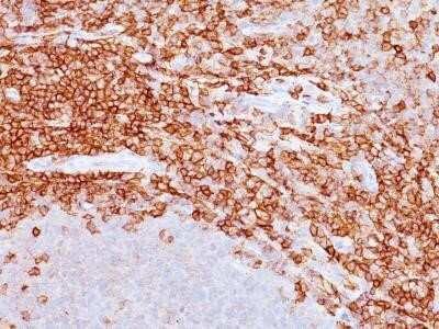 Immunohistochemistry-Paraffin: CD43/Sialophorin Antibody (DF-T1) - Azide and BSA Free [NBP2-33140]