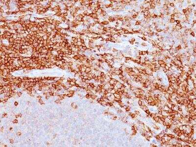 Immunohistochemistry-Paraffin: CD43/Sialophorin Antibody (DF-T1) [NBP2-15190]