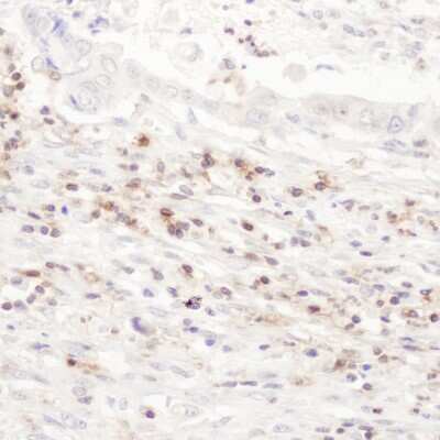 Immunohistochemistry: CD43/Sialophorin Antibody [NBP2-32115]