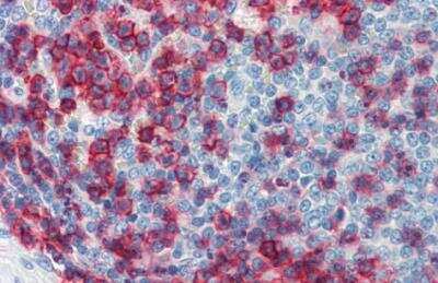 Immunohistochemistry-Paraffin: CD43/Sialophorin Antibody (MEM-59) - Low Endotoxin [NBP2-62227]