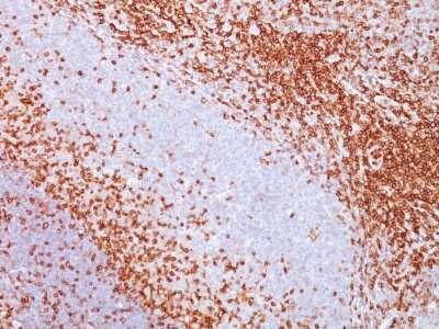 Immunohistochemistry-Paraffin: CD43/Sialophorin Antibody (SPM503) - Azide and BSA Free [NBP2-34775]