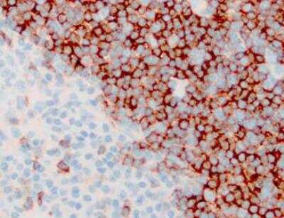 Immunohistochemistry-Paraffin: CD43/Sialophorin Antibody (SPM503) [NBP2-32822]