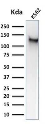 Western Blot: CD43/Sialophorin Antibody (SPM503) [NBP2-32822]