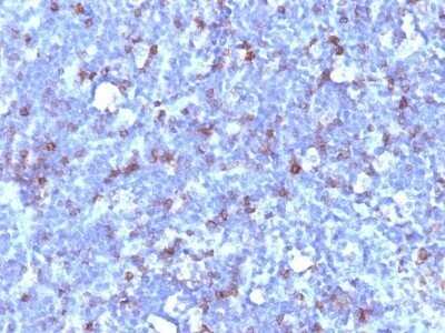 Immunohistochemistry-Paraffin: CD43/Sialophorin Antibody (SPN/1094) - Azide and BSA Free [NBP2-47880]