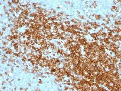 Immunohistochemistry-Paraffin: CD43/Sialophorin Antibody (SPN/1094) - Azide and BSA Free [NBP2-47880]