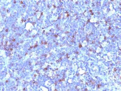 Immunohistochemistry-Paraffin: CD43/Sialophorin Antibody (SPN/1094) - IHC-Prediluted [NBP2-48394]