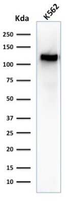 Western Blot: CD43/Sialophorin Antibody (SPN/1094) [NBP2-44651]