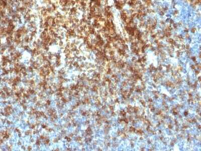 Immunohistochemistry-Paraffin: CD43/Sialophorin Antibody (SPN/1766R) - Azide and BSA Free [NBP2-54344]