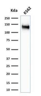 Western Blot: CD43/Sialophorin Antibody (SPN/1766R)Azide and BSA Free [NBP2-54344]