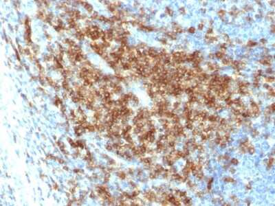 Immunohistochemistry-Paraffin: CD43/Sialophorin Antibody (SPN/2049R) - Azide and BSA Free [NBP3-08244]