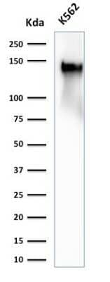 Western Blot: CD43/Sialophorin Antibody (SPN/2049R) [NBP3-07239]