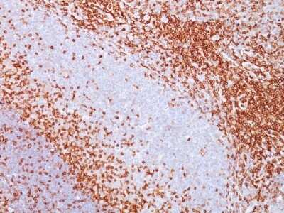 Immunohistochemistry-Paraffin: CD43/Sialophorin Antibody (SPN/839) [NBP2-44648]
