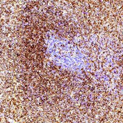 Immunohistochemistry-Paraffin: CD43/Sialophorin Antibody (W3/13) - BSA Free [NB100-64992]