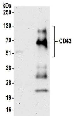 Western Blot: CD43/Sialophorin Antibody [NBP2-32115]