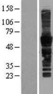 Western Blot: CD43/Sialophorin Overexpression Lysate [NBL1-16412]