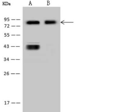 Western Blot: CD44 Antibody (065) [NBP2-90077]