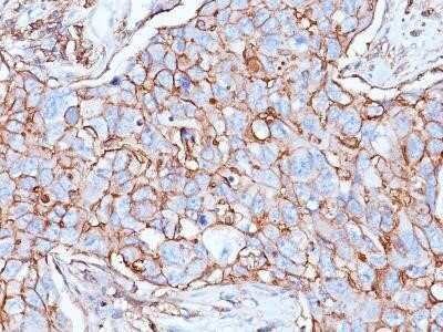 Immunohistochemistry-Paraffin: CD44 Antibody (156-3C11) - IHC-Prediluted [NBP2-45346]