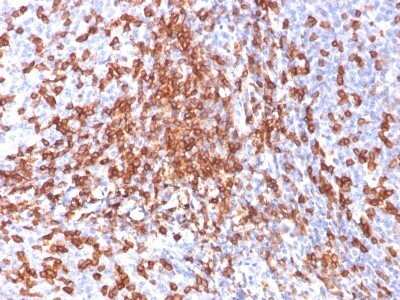 Immunohistochemistry-Paraffin: CD44 Antibody (156-3C11) - IHC-Prediluted [NBP2-45346]