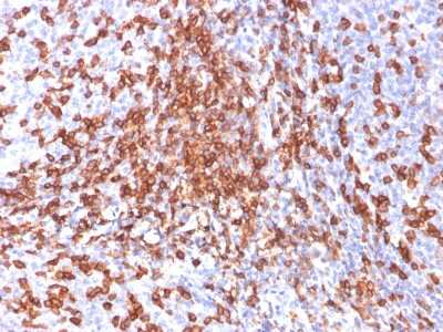 Immunohistochemistry-Paraffin: CD44 Antibody (156-3C11) [NBP2-34327]