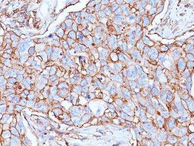 Immunohistochemistry-Paraffin: CD44 Antibody (156-3C11) [NBP2-34327]