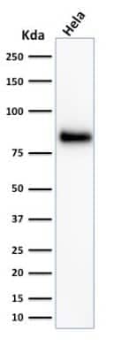 Western Blot: CD44 Antibody (156-3C11) [NBP2-34327]