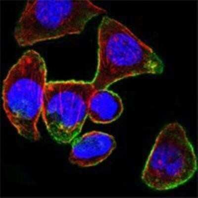 Immunocytochemistry/ Immunofluorescence: CD44 Antibody (8E2F3) - Azide and BSA Free [NBP2-80650]