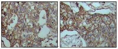 Immunohistochemistry-Paraffin: CD44 Antibody (8E2F3) - Azide and BSA Free [NBP2-80650]