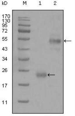 Western Blot: CD44 Antibody (8E2F3)Azide and BSA Free [NBP2-80650]